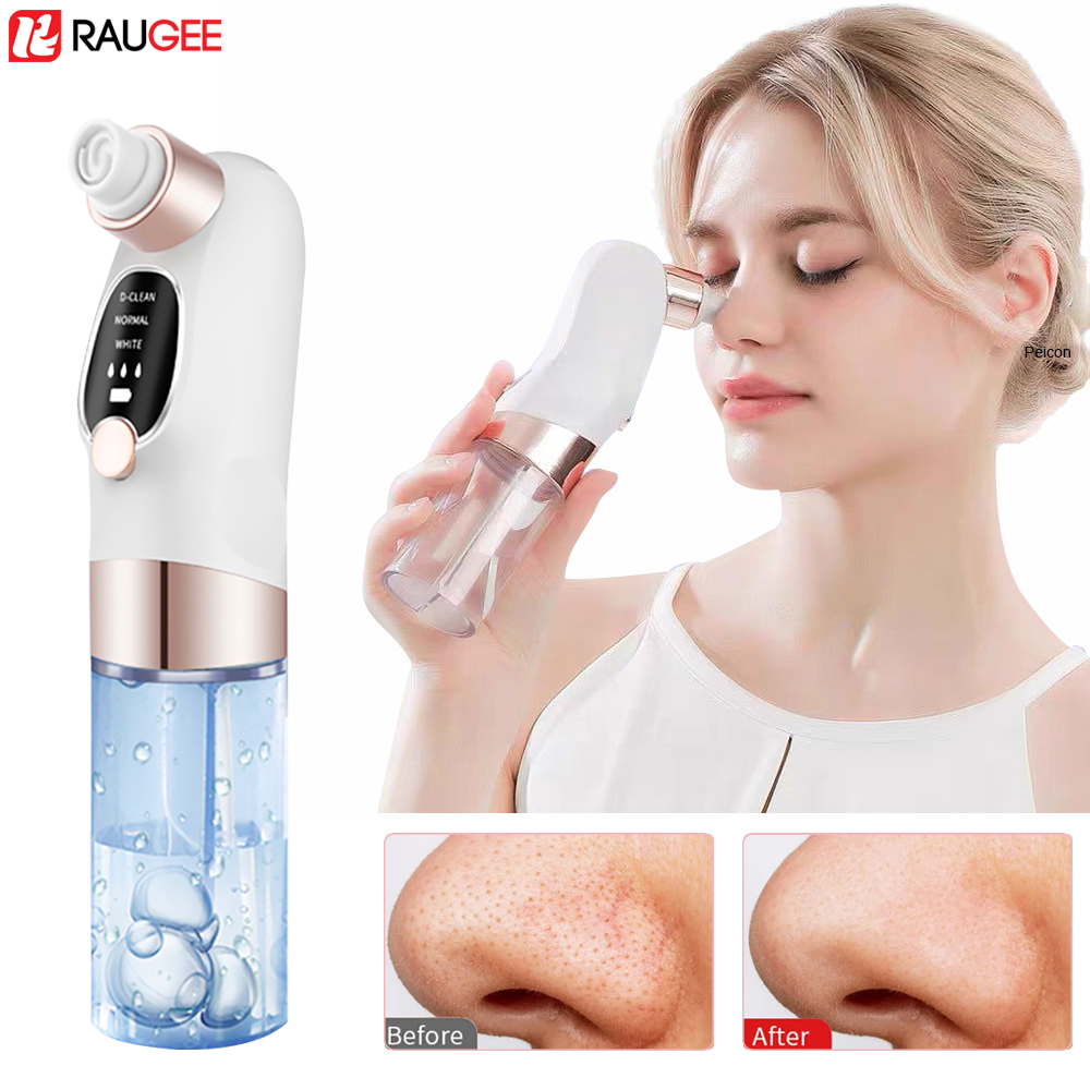 Nasal Aspirator - Estrattore di punti neri Estrattore di