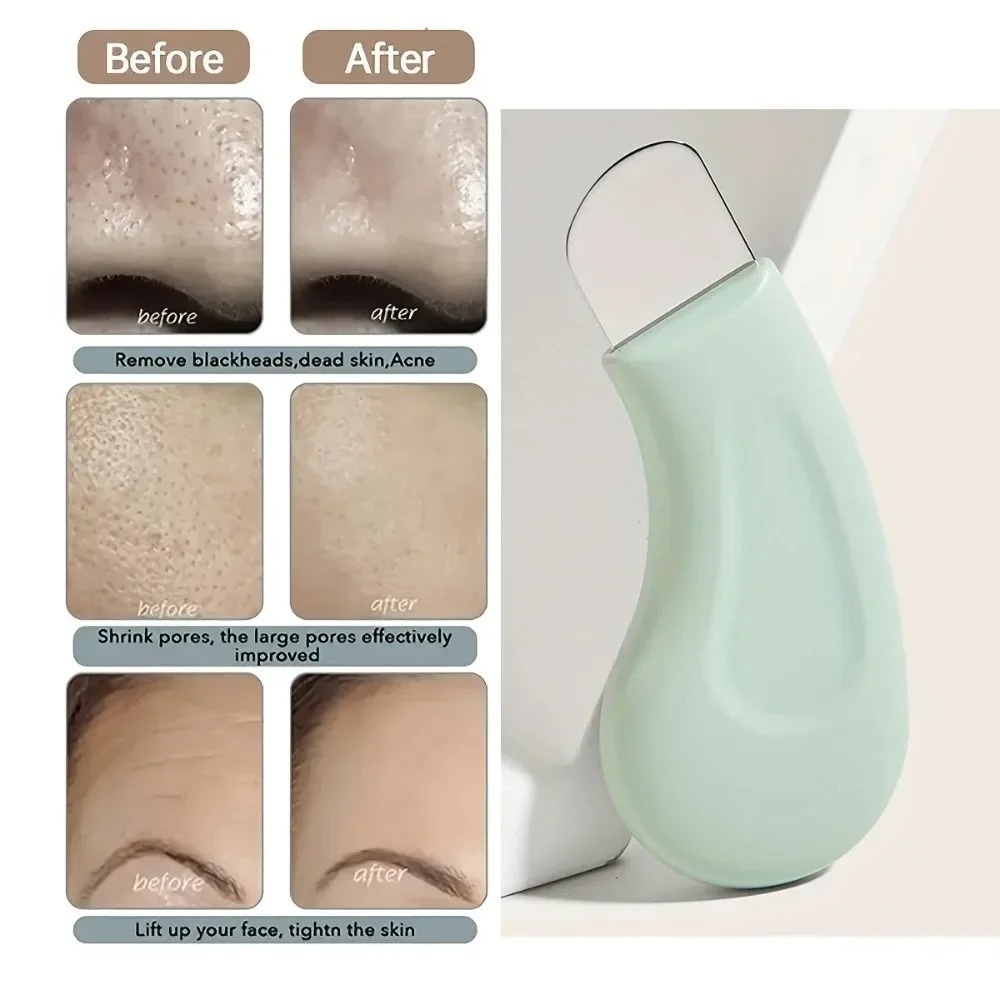 Strumento per la Rimozione di  - Nasal Aspirator recensione e prezzo